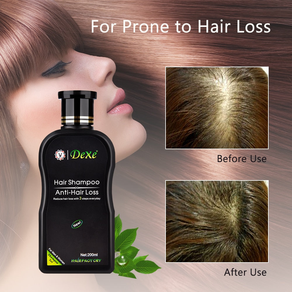 Anti-hair Loss Shampoo Professional Chinese Herbal - HAB 