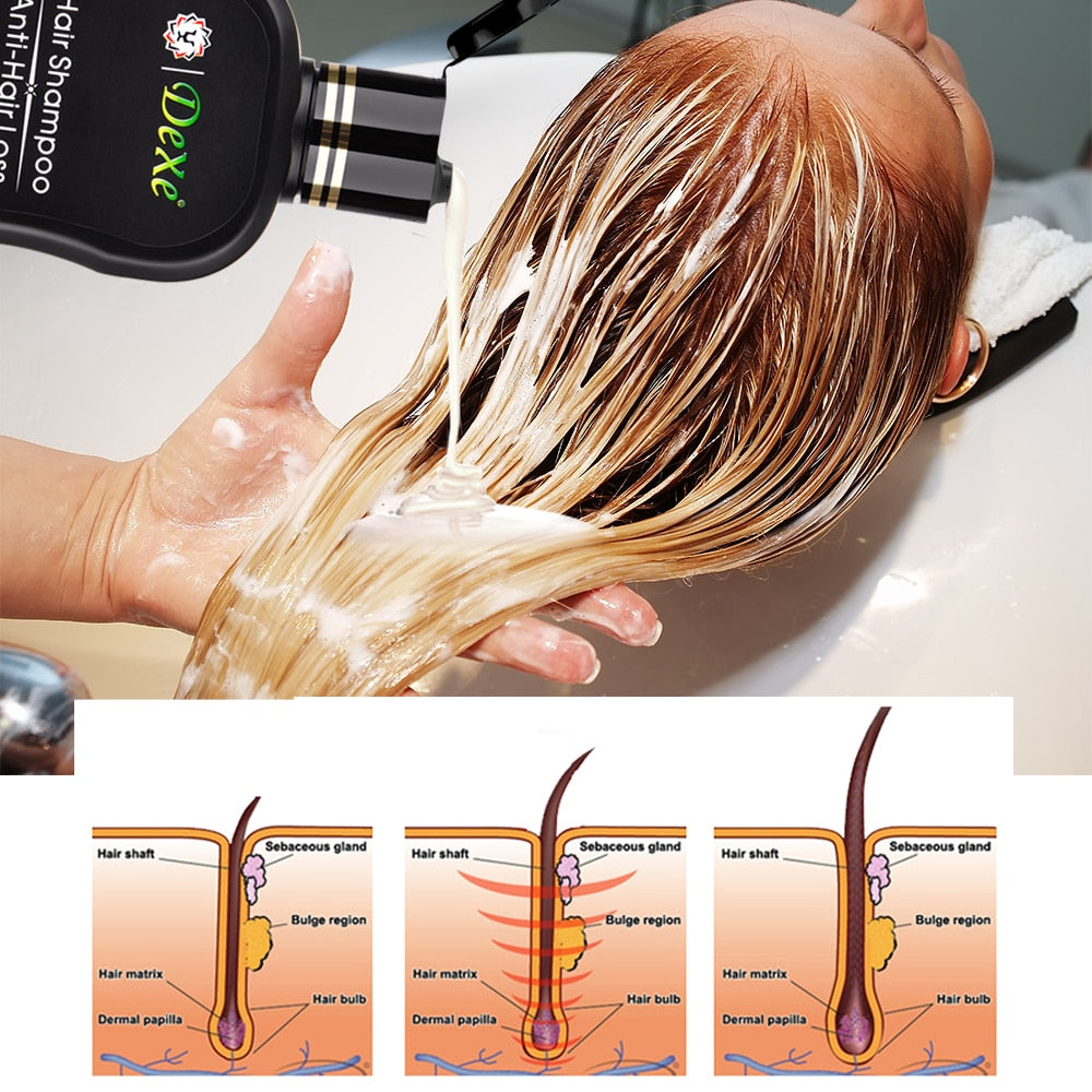 Anti-hair Loss Shampoo Professional Chinese Herbal - HAB 