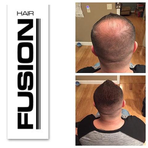 Hair Fusion Easy Start Kit - HAB 